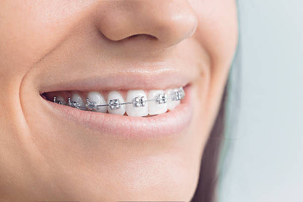 Best Traditional Braces  in Ross, CA